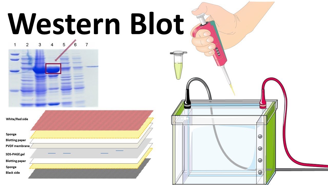 wedtern blot.jpg